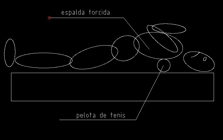 sistema anti ronquidos con pelota de tenis